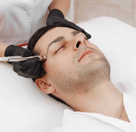 About Microdermabrasion